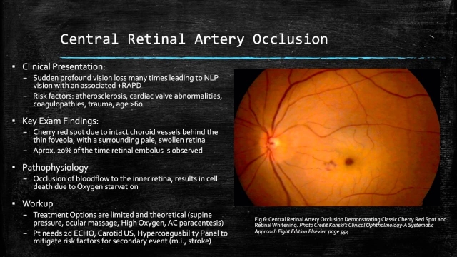 Seeing Clearly: A Journey Through Ophthalmology